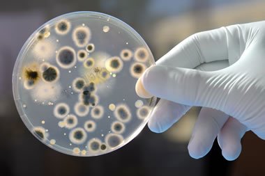 UK Hospitals Face Candida Auris a Drug Resistant Japanese Fungus