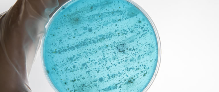 Legionella alert at Kennedy Tower, Royal Edinburgh Hospital