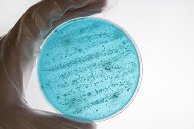 Legionella alert at Kennedy Tower, Royal Edinburgh Hospital, Scotland