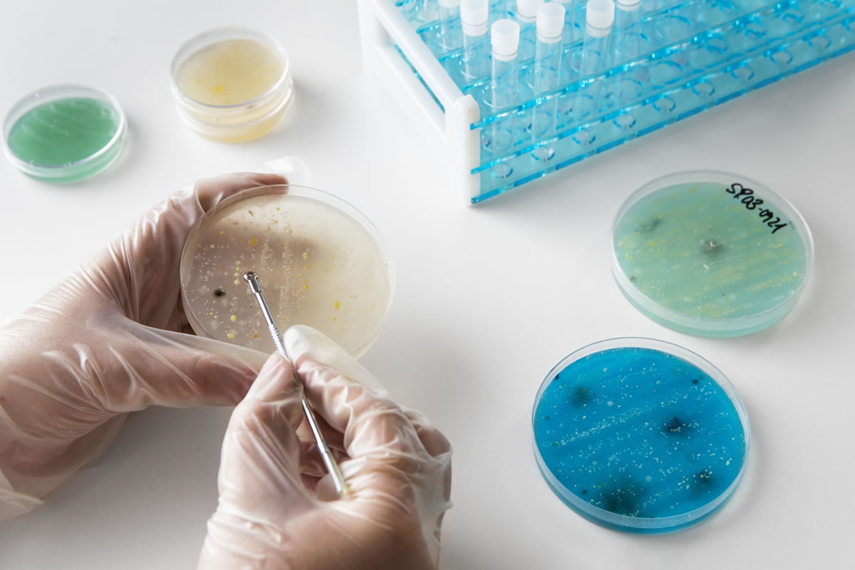 Scientist in laboratory testing Legionella bacteria using petri-dish