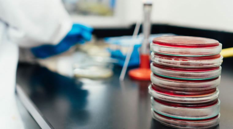 Legionella testing technologies and stacked agar plates used for culture testing